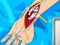 խաղ Arm surgery 2