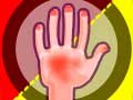 խաղ Hands Attack
