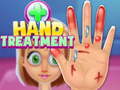 խաղ Hand Treatment