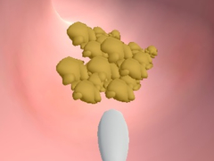 խաղ Earwax Clinic